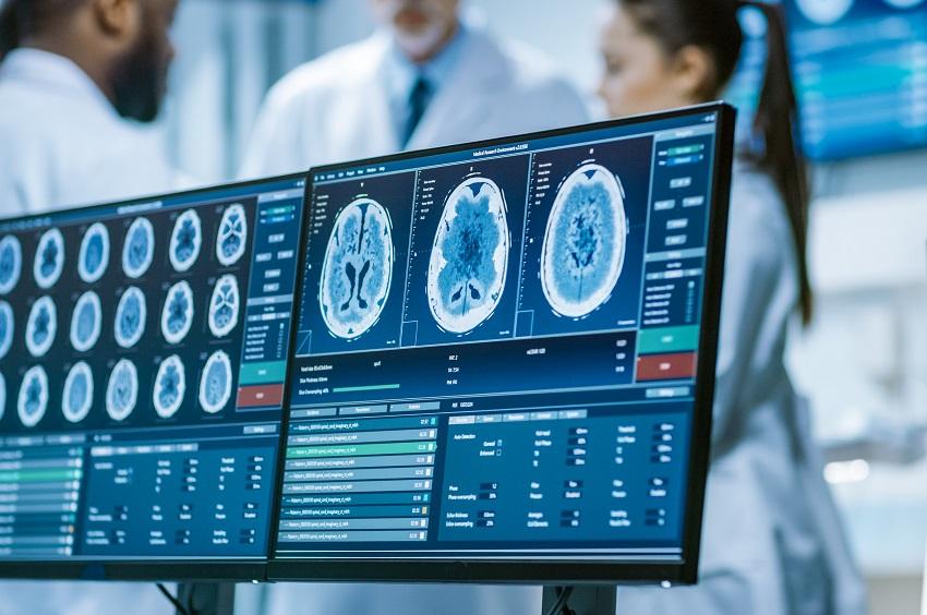 Alzheimer: SUS registra 56,2 milhões de atendimentos em um ano